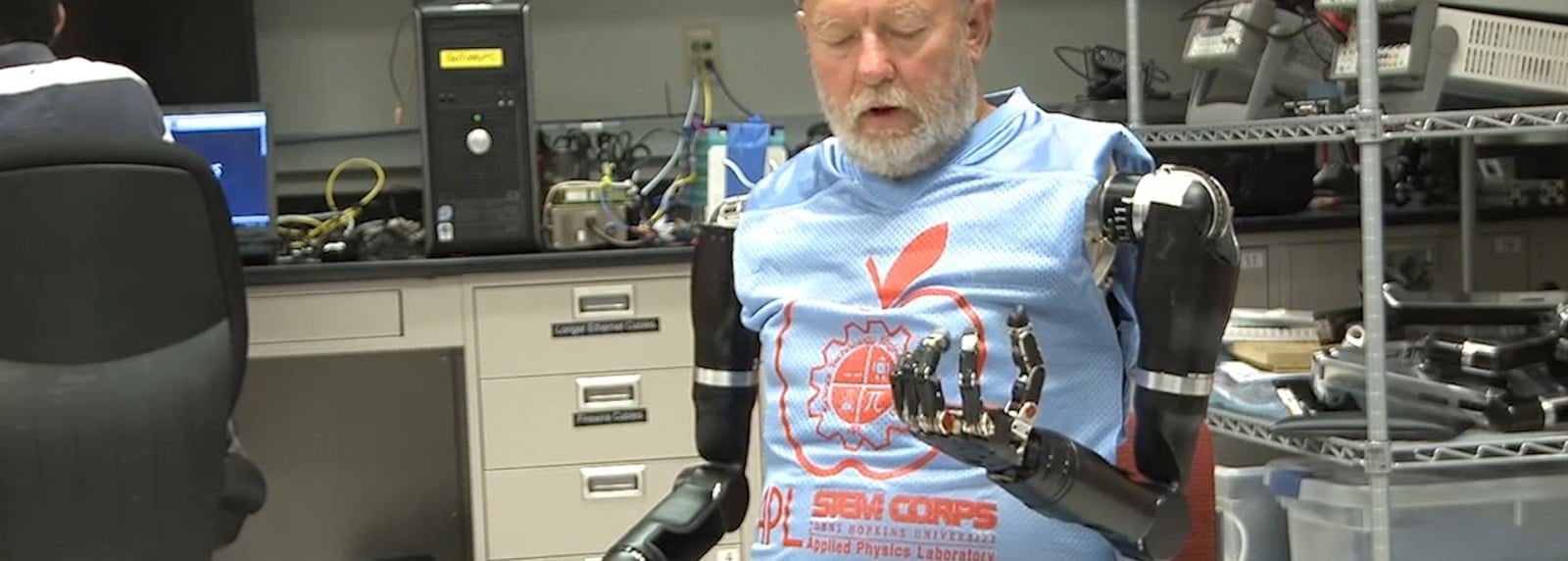 Double Amputee Controls Two Prosthetic Arms Just His Mind E1419196265368 مجلة نقطة العلمية