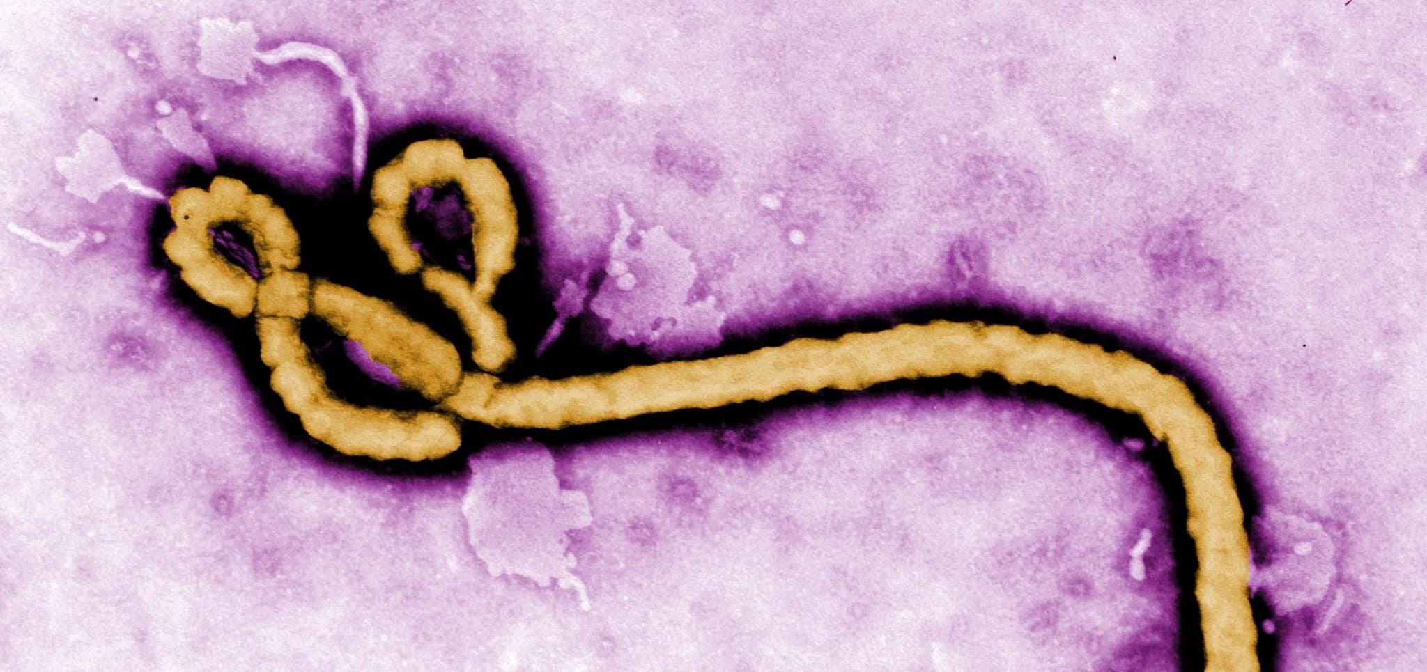 Ebola Virus 2 E1461753404761 مجلة نقطة العلمية