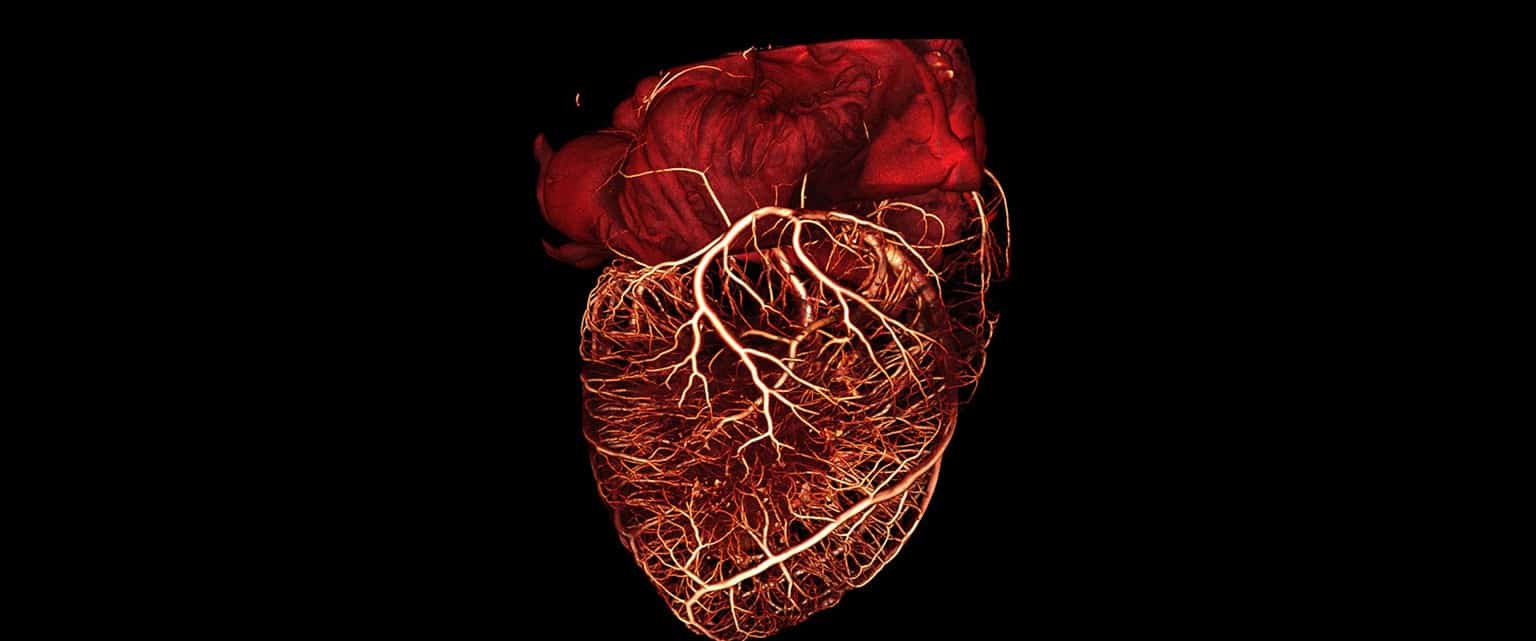heart 3d ct scan e1451985933214 صناعة أوعية دموية بشرية باستخدام طابعة ثلاثية الأبعاد مجلة نقطة العلمية
