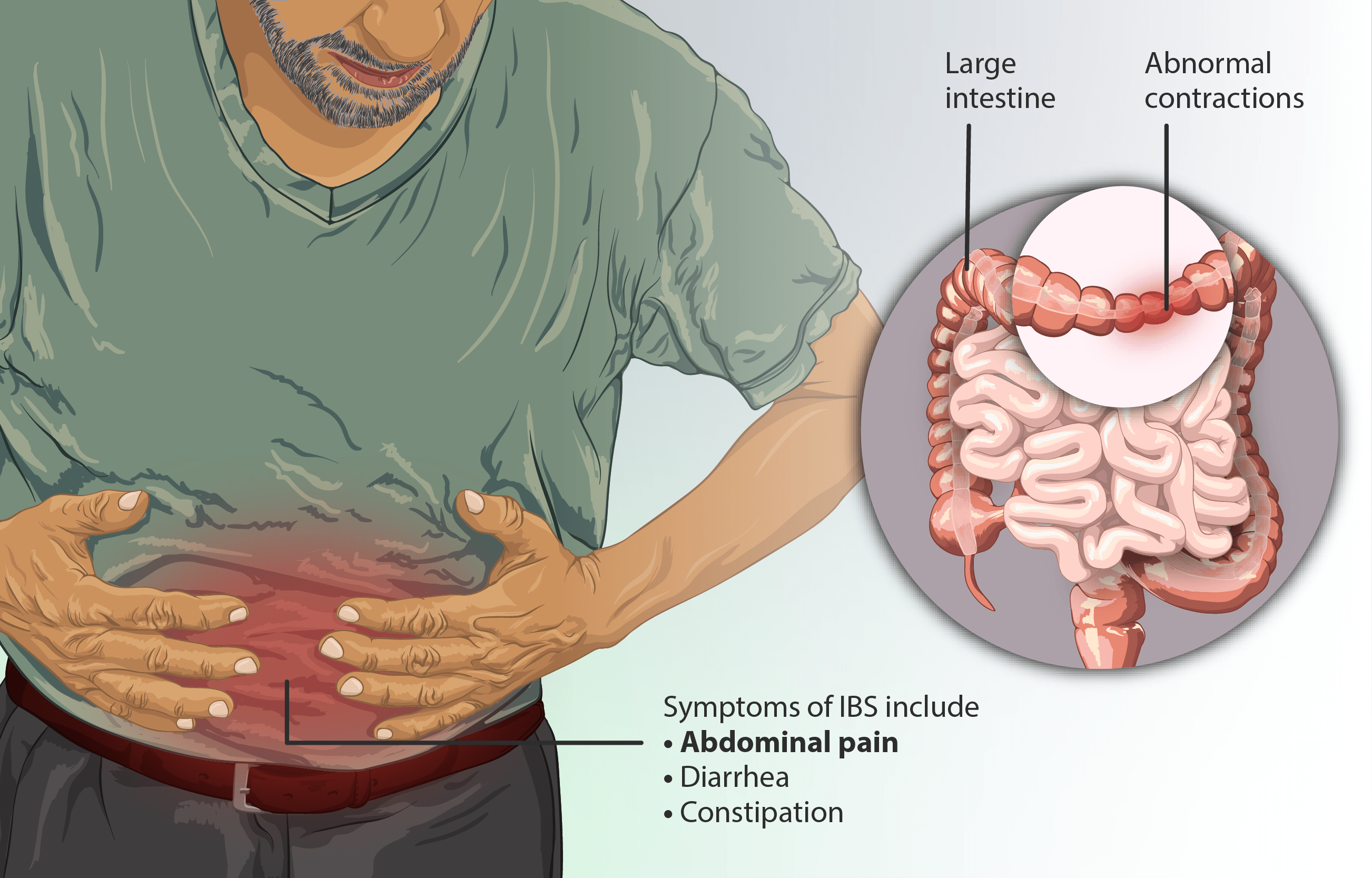 Depiction of a person suffering from Irritable Bowel Syndrome IBS القولون العصبي.. مرض مزمن أم حالة مؤقتة! مجلة نقطة العلمية