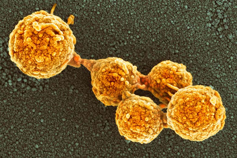 c0099123 synthetic mycoplasma bacteria sem web هل يمكن أن تنمو الخلايا الاصطناعية في المختبر وتنقسم مثل البكتيريا الطبيعية؟ مجلة نقطة العلمية