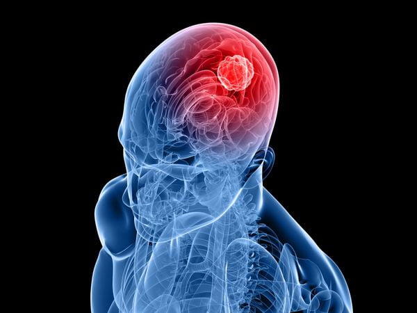 Drugs Brain Tumors مجلة نقطة العلمية