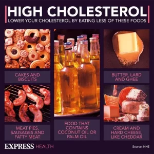 High Cholesterol Tips 3679606 مجلة نقطة العلمية