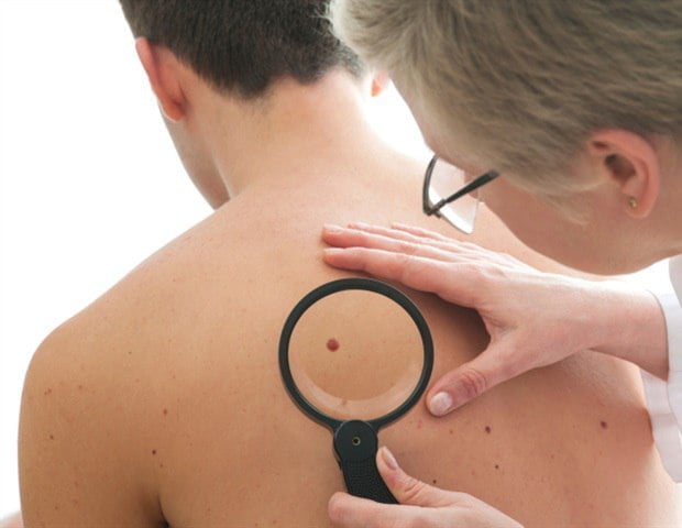 photo 2020 12 07 06 25 44 اكتشاف سيساعد في تطوير علاجات أكثر فعالية لسرطان الجلد الميلانيني مجلة نقطة العلمية