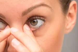 Woman Rubbing Eyes Blurry Vison مجلة نقطة العلمية