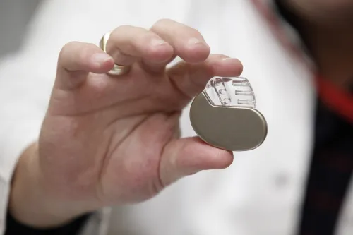 heart pacemaker اختراعات غيرت العالم تم اكتشافها عن طريق الصدفة مجلة نقطة العلمية